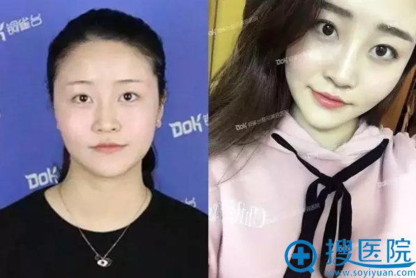 韩式半纹眉前后对比 韩式半纹眉前后对比
