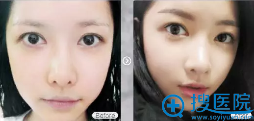 韩式半纹眉对比图 韩式半纹眉对比图