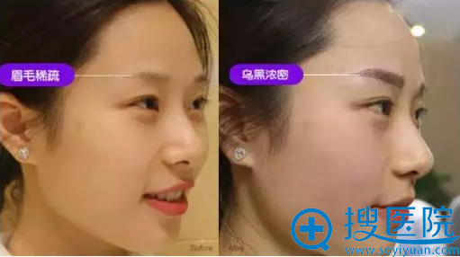 自然柔绣眉对比案例 自然柔绣眉对比案例