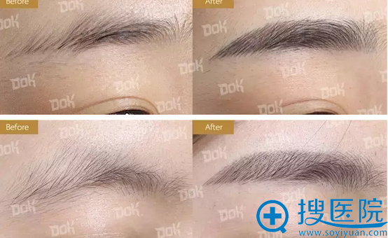 自然柔绣眉前后对比案例 自然柔绣眉前后对比案例