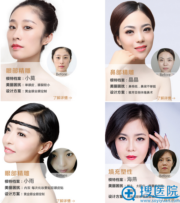 石家庄雅芳亚整形医院案例前后对比图 石家庄雅芳亚整形医院案例前后对比图