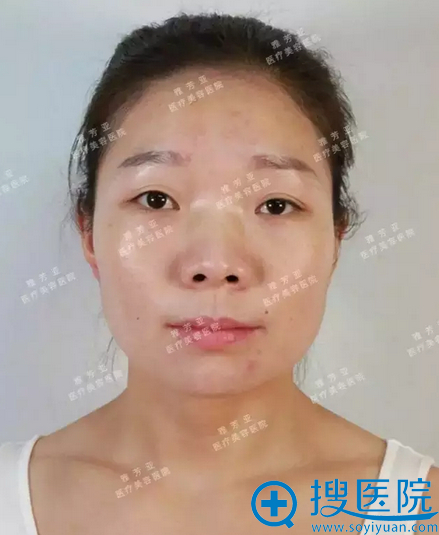 术前照 术前照