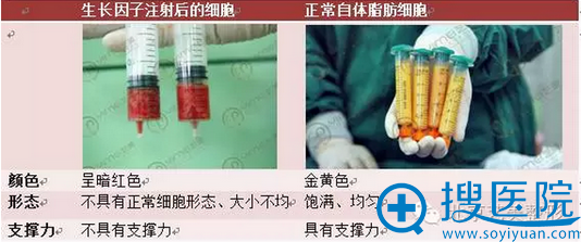 生长因子注射后的细胞和正在自体脂肪细胞对比 生长因子注射后的细胞和正在自体脂肪细胞对比
