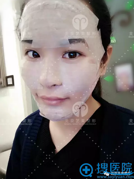 术后清醒即刻照片 术后清醒即刻照片