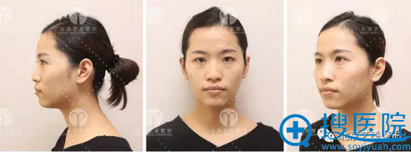 手术前全方位照片 手术前全方位照片