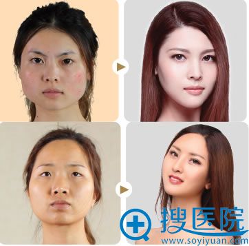 贵阳美莱整形案例图 贵阳美莱整形案例图