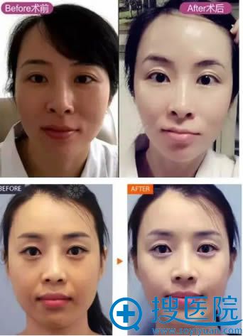 贵阳华美案例对比图 贵阳华美案例对比图