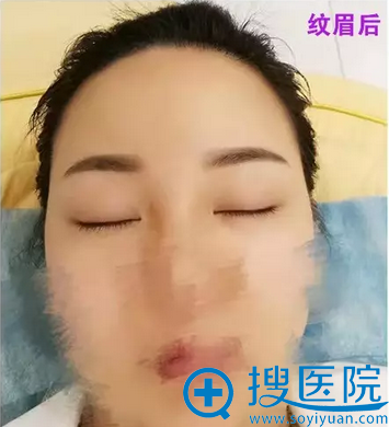贵阳美贝尔医疗美容医院陈仪纹眉案例 贵阳美贝尔医疗美容医院陈仪纹眉案例