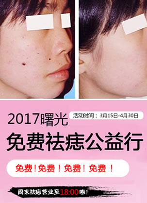 2017福州曙光整形激光去痣公益活动开始拉 有痣之士赶紧预约
