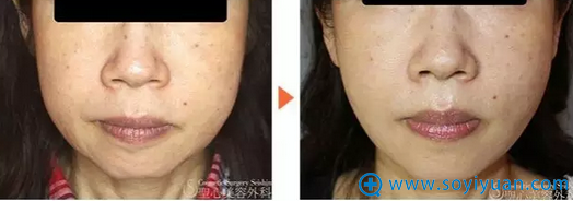 Ƭ�Զ����沿����������ǰ��ԱȰ���