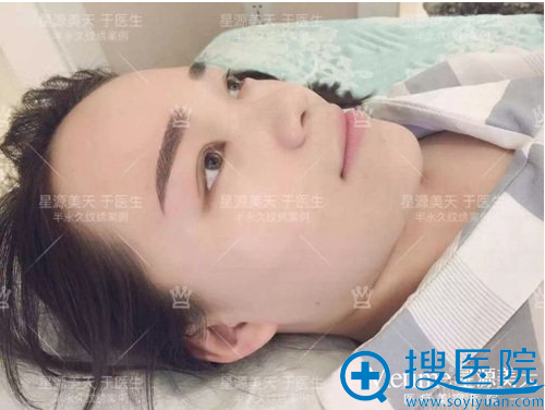 <!--<i data=20240710 data-id=12773></i>-->于瑶韩式半纹眉案例 <!--<i data=20240710 data-id=12773></i>-->于瑶韩式半纹眉案例