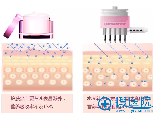 里的玻尿酸,和注射用玻尿酸有什么区别? 里的玻尿酸,和注射用玻尿酸有什么区别?