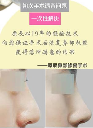 韩国原辰整形朴原辰院长介绍什么情况下需要做鼻部修复手术?