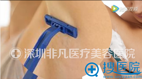 微波祛腋臭术前备皮 微波祛腋臭术前备皮