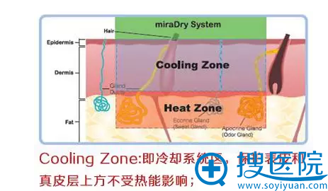 微波祛腋臭水冷却系统治疗时不会灼伤周围皮肤组织 微波祛腋臭水冷却系统治疗时不会灼伤周围皮肤组织