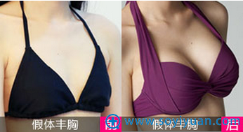 <!--<i data=20240710 data-id=16801></i>-->亲诊项目:假体丰胸 <!--<i data=20240710 data-id=16801></i>-->亲诊项目:假体丰胸
