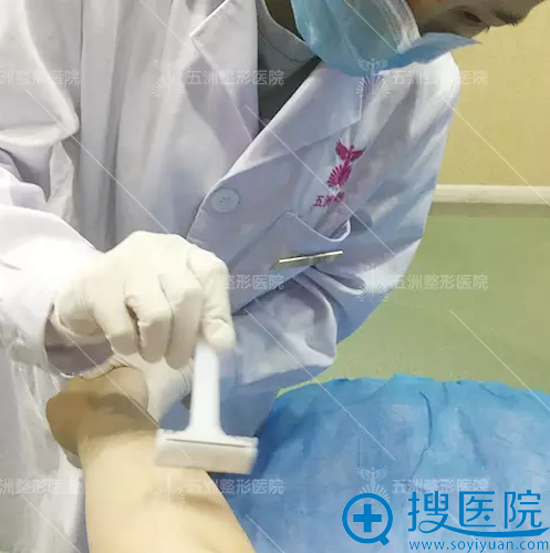 开始脱毛备皮 开始脱毛备皮
