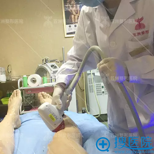 大腿激光脱毛进行中 大腿激光脱毛进行中