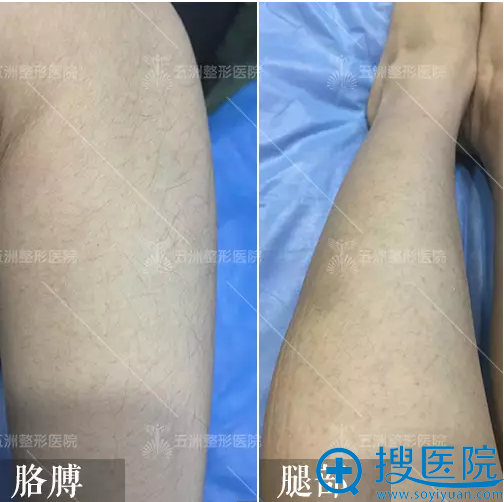 看看我胳膊和大腿的汗毛 看看我胳膊和大腿的汗毛
