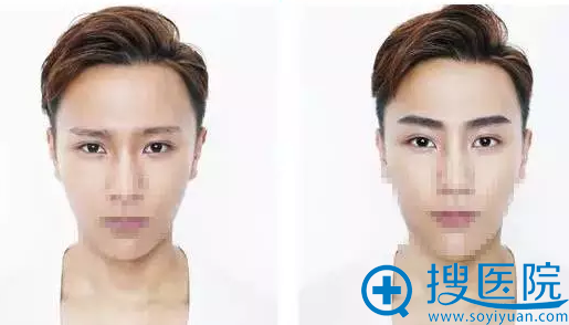 男士纹眉案例 男士纹眉案例