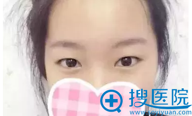 术前的我,没有精神 术前的我,没有精神
