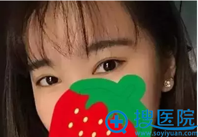 现在的我,谁能看出我割了双眼皮 现在的我,谁能看出我割了双眼皮