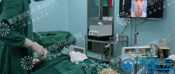 开始进行抽脂 开始进行抽脂