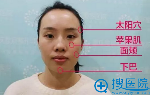 术前的我 术前的我
