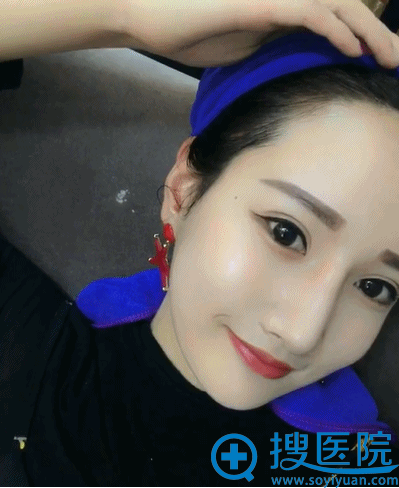 【经历】看妹子分享在上海华美找李志海做下颌角+颧弓内推经验