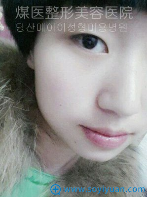 ��ɽúҽ����ҽԺ�泩˫��Ƥ�����ָ��ռ� ˫��Ƥ680Ԫ