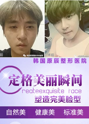 看我在韩国原辰做面部轮廓和眼部+鼻部修复效果 两个月变美少男