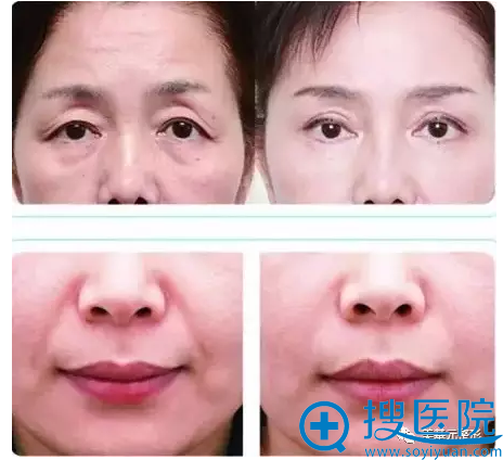 �ƽ������ڰ���