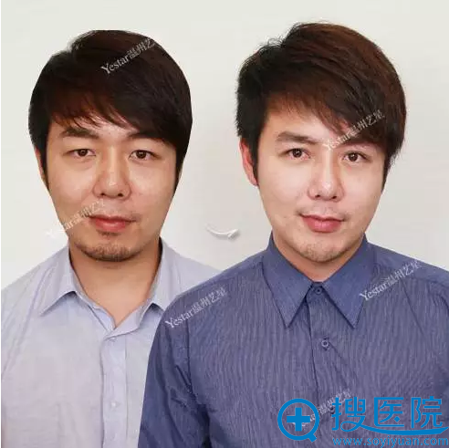 术前术后对比 术前术后对比