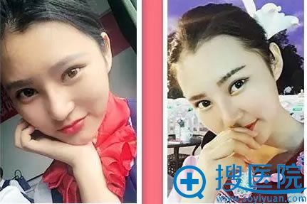 �ڹ���������˫��Ƥ+���۽�һ����Ч��