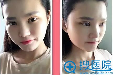 �ڹ���������˫��Ƥ���۽�����7����