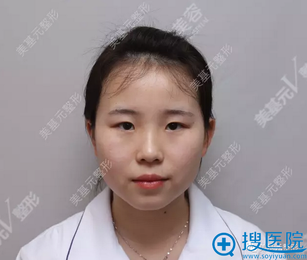 �����˰������人����Ԫ����ҽԺ�����Ժ�����İűȵ���˫��Ƥ