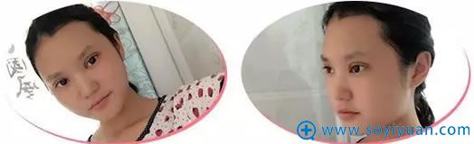 �ڹ���������˫��Ƥ���۽�����3����