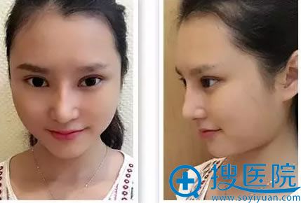 �ڹ���������˫��Ƥ���۽���������