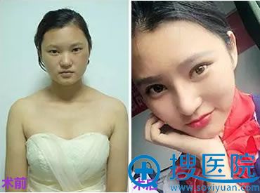 �ڹ���������˫��Ƥ+���۽�ǰ��Ա���
