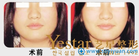 �Ϻ�Yestar������֬���������Ա���