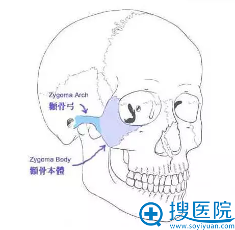 颧弓的位置 颧弓的位置
