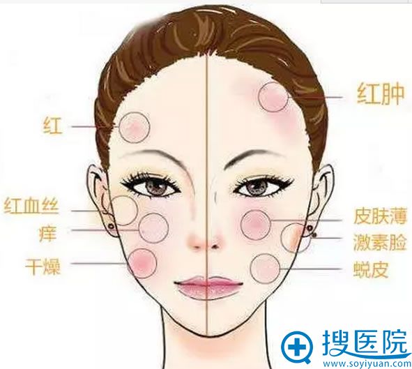 还在为皮肤的红、痒、干燥、红血丝烦恼吗?苏州华美五一美肤节帮你还原肌肤健康状态 还在为皮肤的红、痒、干燥、红血丝烦恼吗?苏州华美五一美肤节帮你还原肌肤健康状态