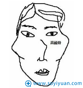 颧骨特别高的人 颧骨特别高的人