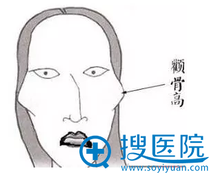 高颧骨人的样貌 高颧骨人的样貌