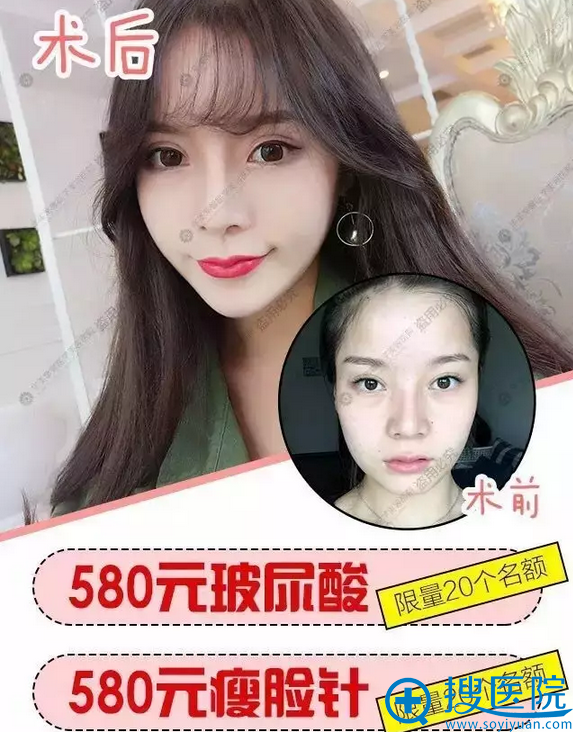 ������ܰ��������۸�580Ԫ