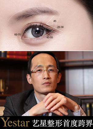 �人���Ƕ�־��Ժ������˫��Ƥ������ô������ȷ��ܿ�������