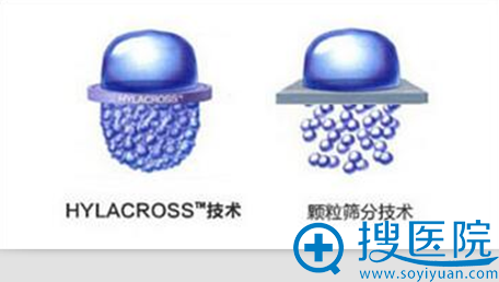 了解西安高一生玻尿酸王者乔雅登 玻尿酸等产品优惠价目表