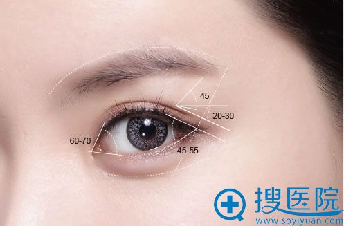 武汉艺星双眼皮示意图 武汉艺星双眼皮示意图