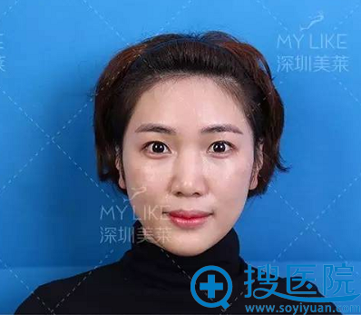 术前存档照片 术前存档照片