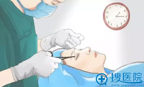 做双眼皮医生缝合过紧示意图 做双眼皮医生缝合过紧示意图